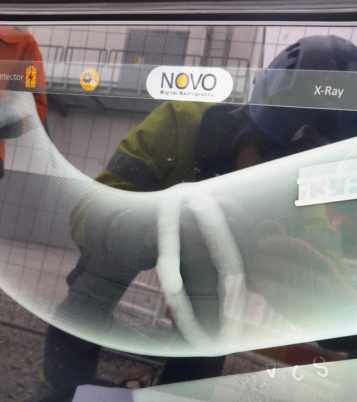 Näytöllä näkyy digitaalinen röntgenkuva hitsauksen tarkastuksesta, taustalla työntekijä.